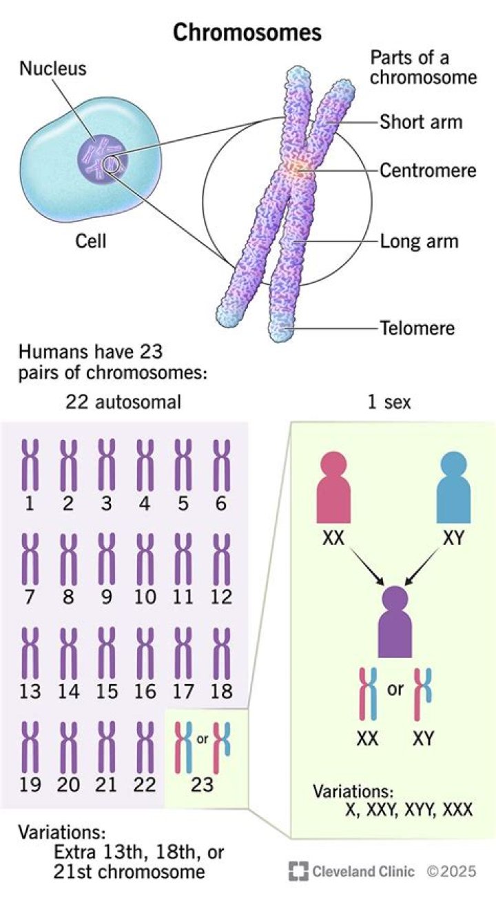 How many chromosomes does a special needs person have?