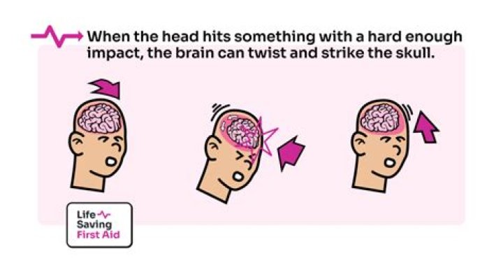 What happens if a kid gets hit in the head?